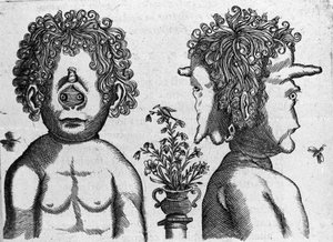 異なるタイプの人間の怪物：顔と怪物の頭の顔。イタリアの科学者Fortunio Liceti(1577-1656)の「De monstrorum natura, causis et differentiis」からのエングレーヴィング。1646 作： Italian School