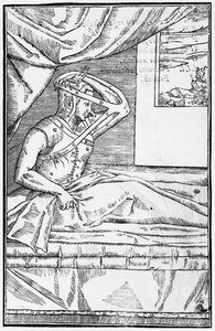 鼻の再建手術、Gaspare Tagliacozzi（1545-99）Venice、1597年発行のInsitionemによるDe curtorum chirurgiaのイラスト、1597年発行 作： Italian School