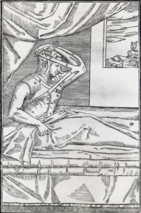 患者の鼻を上腕部の皮膚のフラップに貼り付ける鼻形成術 作： Italian School