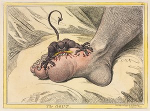 痛風 作： James Gillray