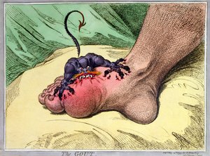 痛風、1799年にハンナハンフリーによって発行された（手塗りの軟地エッチング）