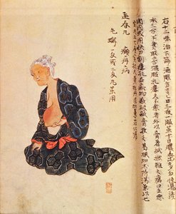 花岡誠秀（1760-1836）が1804年に全身麻酔下で行った乳がんの最初の外科的治療 作： Japanese School