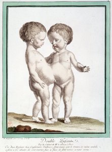 シャムの子供たち - レグノーの「自然の逸脱」にて 作： Jean Baptiste Regnault
