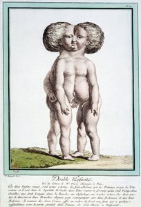 シャムの子供たち - レグノーの「自然の逸脱」にて 作： Jean Baptiste Regnault
