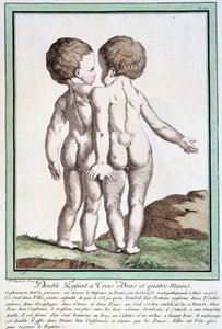 シャムの子供たち - レグノーの「自然の逸脱」にて 作： Jean Baptiste Regnault