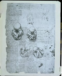 子宮内の胎児の5つのビュー、ファクシミリコピー 作： Leonardo da Vinci