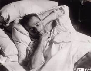 エゴン・シーレの死の床、1918年。 作： Martha Fein