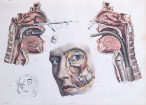 鼻の手術、ジャンバティストマルクブールジュリー（1797-1849）1866-67による「Traite Complet de l&39;Anatomie de l&39;Homme」のプレート 作： Nicolas Henri Jacob