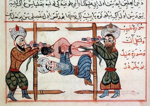 骨折の縮小。シャラフ・アル＝ディンのトルコ医学書のミニチュア 作： Ottoman School
