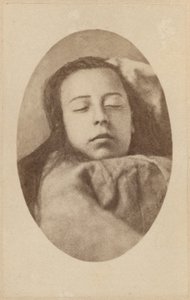 ヒステリーの攻撃、第2フェーズ、ボーンビルとP.レナードの「Iconographie Photographique de La Salpetriere」のイラスト、プレートIII、パリ、1876（アルブメンプリント） 作： Paul Regnard