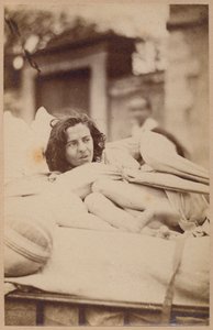 ヒステリーてんかん、発作、ゆがみ、プレートXXXVII、ボーンビルとP.レニャール、パリ、1876年の「Iconographie Photographique de La Salpetriere」（アルブメンプリント） 作： Paul Regnard