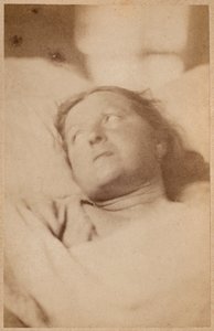 ヒステリーてんかん、はりつけ、頭の態度、ボーンヴィルとP.レニャールの「Iconographie Photographique de La Salpetriere」からのプレートVII、パリ、1876年（アルブメンプリント） 作： Paul Regnard