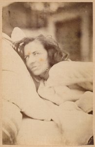 ヒステリーてんかん、せん妄、欲望、プレートXXXVI、「Iconographie Photographique de La Salpetriere」Bourneville and P. Regnard、パリ、1876（アルブメンプリント） 作： Paul Regnard