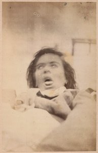 ヒステリーてんかん、幻覚、苦痛、プレートXXIX、「Iconographie Photographique de La Salpetriere」、BournevilleおよびP. Regnard、パリ、1876年（アルブメンプリント） 作： Paul Regnard