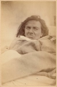 ヒステリーてんかん、幻覚、不快感、プレートXXXVボーンビルとP.レニャールによる「Iconographie Photographique de La Salpetriere」、パリ、1876年（アルブメンプリント）