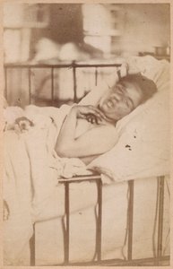 ヒステリーてんかん、永久収縮、プレートXXVIII、「Iconographie Photographique de La Salpetriere」、ボーンビルとP.レニャール、パリ、1876年（アルブメンプリント） 作： Paul Regnard