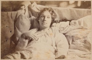 ヒステリーてんかん、終末期、メランコリックせん妄、ボーンヴィルらのP.レニャールによる「Iconographie Photographique de La Salpetriere」のイラスト、プレートXIX、パリ、1876（アルブメンプリント） 作： Paul Regnard