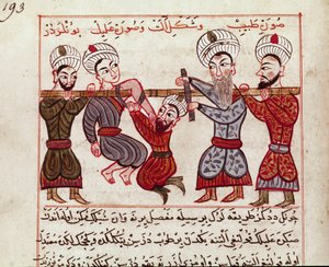 医学：整形外科的介入。Charaf-ed-din (Charaf ed Din) (1404-1468)によるトルコ医学の乳液から抜粋したミニチュア。"La Surgery Imperiale" (Ms Sup Turk 693 fol. 193) 1466 Paris, B.N. 作： Persian School