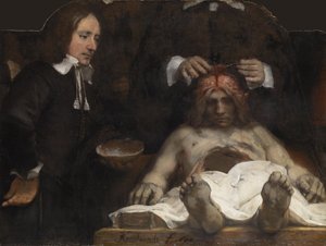 ヤンデイマン博士の解剖学レッスン、1656年 作： Rembrandt van Rijn