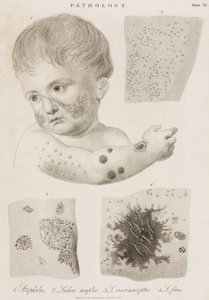 皮膚科学 皮膚疾患の種類 作： John Pardon