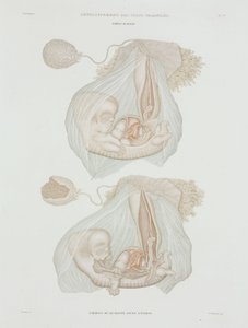 Gynaecology 40日目の胎児（1847-1859年頃