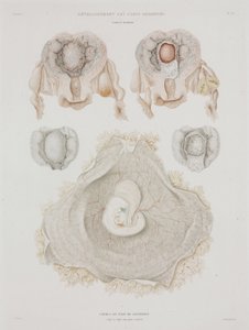 婦人科 胎児のいる人間の子宮 1847-1859年頃 作： John Pardon