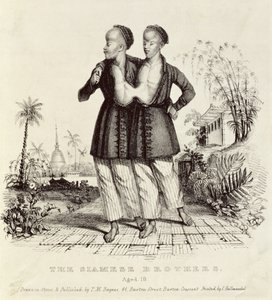 18歳のシャム兄弟、チャールズハルマンデル（1789〜1850年）、1829年頃