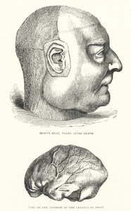 ジョナサン・スウィフトの生涯を描いたイラスト（エングレーヴィング 作： Thomas Morten