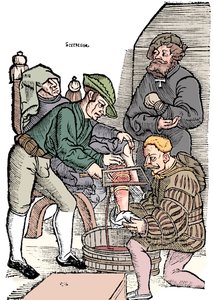 麻酔なしの脚の切断、1593 作： Unbekannt