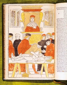 1483年、イタリアのパドヴァでの解剖学の講義 作： Unbekannt