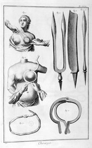 乳房手術、1751-1777 作： Unbekannt