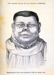 15歳のクレチン、c1890 作： Unbekannt