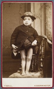 疾患, くる病 (Rachitisme, jambes rachitiques) くる病の子供 作： Unbekannt