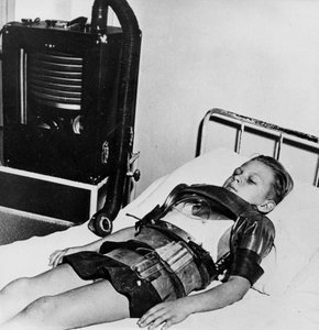 鉄肺の11歳の少年、ボージョン病院、パリ、c1947-1951 作： Unbekannt