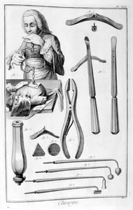 頭の手術、1751-1777