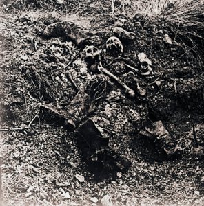 人間の遺体、c1914-c1918 作： Unbekannt