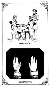 催眠術：1889年 作： Unbekannt