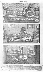 1556年のAvicennaによる医療Cordialibusの正典の本から 作： Unbekannt