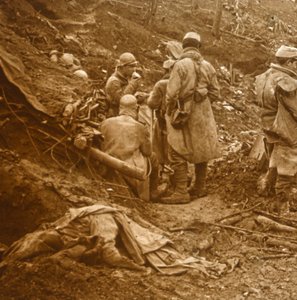1915年北フランス、レザルパージュ 作： Unbekannt