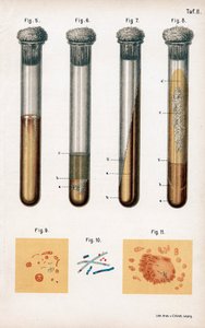 さまざまな種類の細菌、1889 作： Unbekannt