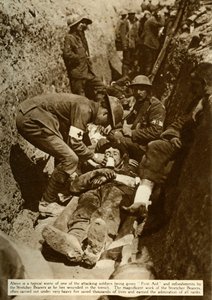 トレンチで扱われている負傷した兵士、ソンムの戦い、第一次世界大戦、1916年、1935年。 作： Unbekannt