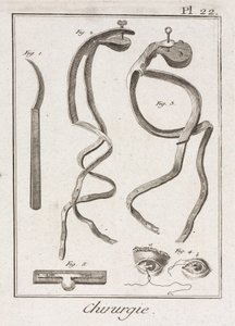 装置、近世の目の手術 作： Unbekannt