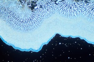 顕微鏡写真（光） コロイダルシリカ、光顕微鏡写真 作： Unbekannt