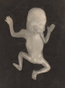 生後5ヶ月の胎児の骨化の程度 作： Unknown