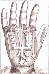 フランスの外科医アンブロワーズ・パルによる義手 作： Unknown artist