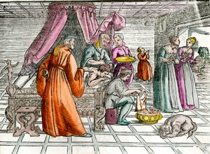 医者。"A trepanation" 外科医が患者の頭蓋骨を手術する。16世紀のエングレーヴィング プライベート・コレクション 作： Unknown artist