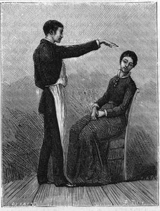 催眠現象：患者の目の前で突然手を伸ばすことで催眠が起こる。1881年に作成された版画。 作： Unknown artist