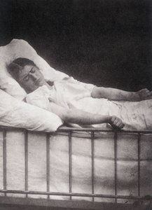 Hystero Epilepsie - Paul Regnard and Bournevilleによる "Photographic iconography of Salpétrière: service of Mr Charcot "での破傷風の発作 作： Unknown artist