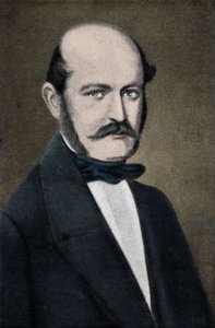 ハンガリーの産科医イグナズ・フィリップ・ゼンメルヴァイス（ゼンメルヴァイス）の肖像（1818～1865年）。 作： Unknown artist