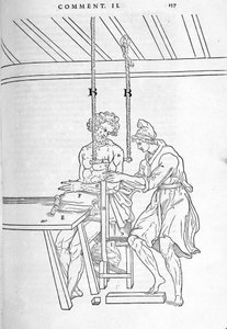骨折の軽減。カルロ・ステファノ・リベリオ著「人間の体の部分的な解剖」（1545年、パリ）の図解版。「カルロ・ステファノ・リベリオ著、1545年パリ。 作： Unknown artist